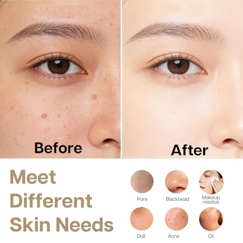 Face Scrubber, Thermal & Cooling Modes, Face Brush, Deep Pore Cleansing, Silicone Face Scrubber, Electric Sonic Vibrations, Facial Cleansing Brush, Waterproof Home Spa & Travel Skincare