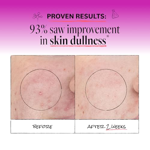 DERMA E Microdermabrasion Exfoliating Face Scrub, Revitalizes & Renews 2 Oz