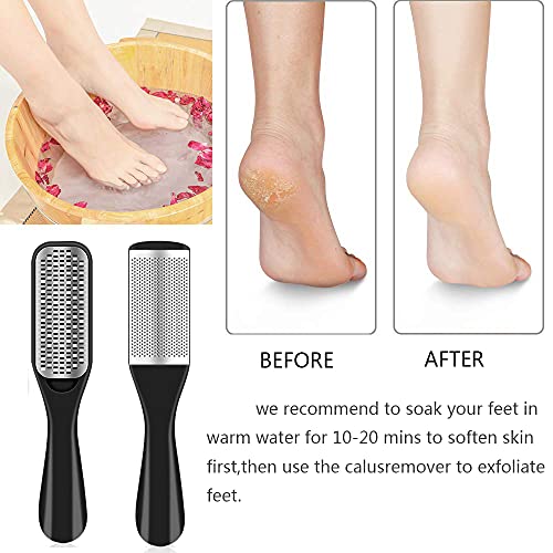 36 in 1 Professional Pedicure Kit, Foot File, Foot Rasp and Callus Remover - style: Black