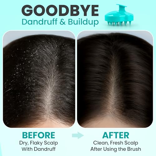 RELAXXO Scalp Massager Hair Growth – Exfoliator & Hair Scrubber for Scalp, Soft Bristles for Dandruff & Soothing Comfort, Shampoo Brush, Wet & Dry Use, Green - color: Green