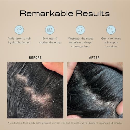 Jupiter Scalp Exfoliator - Scalp Massager Tool for Wet & Dry Hair - Ergonomic Detangler Brush - Dandruff Comb & Scrub to Remove Dandruff & Buildup and Support Circulation - 2 Pack, Black - color: Black 2 Pack