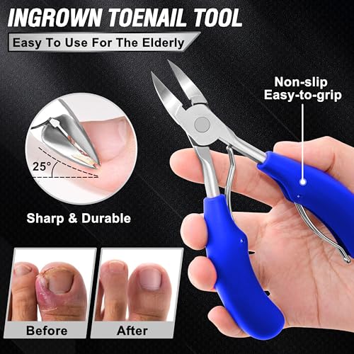 Toenail Clippers for Seniors Thick Toenails, Aucurwen Heavy Duty Toe Nail Clippers Adult Thick Nails Long Handle, Large Toenail Clippers for Thick Nails 7Pcs(Blue) - color: Blue