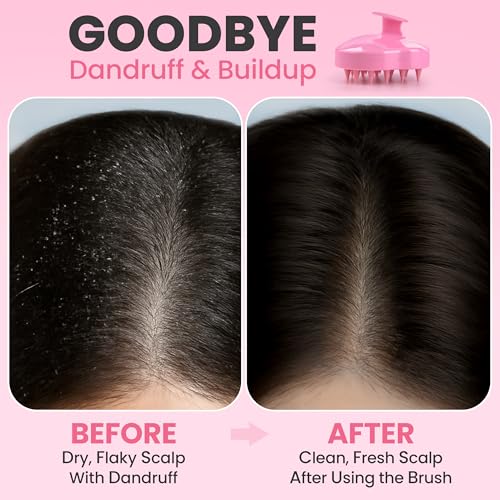 RELAXXO Scalp Massager Hair Growth – Exfoliator & Hair Scrubber for Scalp, Soft Bristles for Dandruff & Soothing Comfort, Shampoo Brush, Wet & Dry Use, Pink - color: Pink