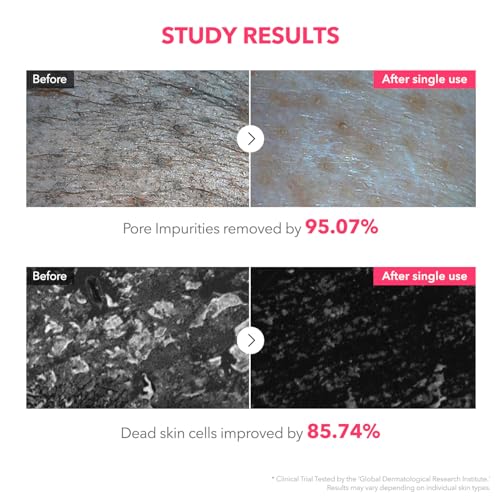 APRILSKIN TXA Bubble Gum Cleanser with Pore Brush