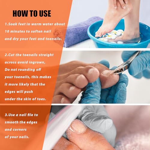 LePinko Podiatrist Toenail Clippers, Thick and Ingrown Nails Clippers, 1PCS - size: 1 piece